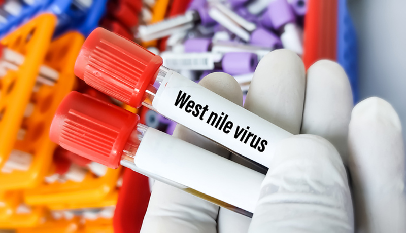Westnile Virus Test Istock 1346238322