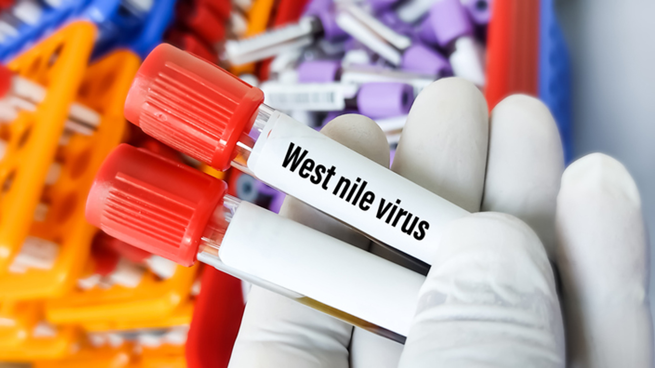 Westnile Virus Test Istock 1346238322